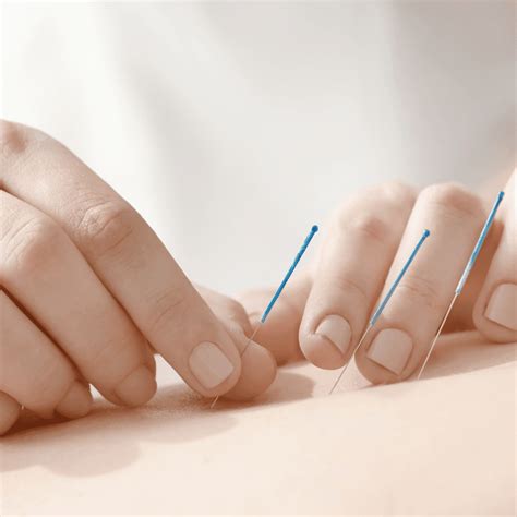 aKOpuncture .